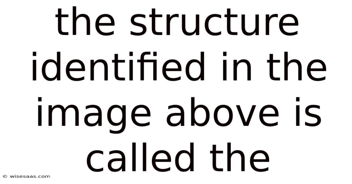The Structure Identified In The Image Above Is Called The
