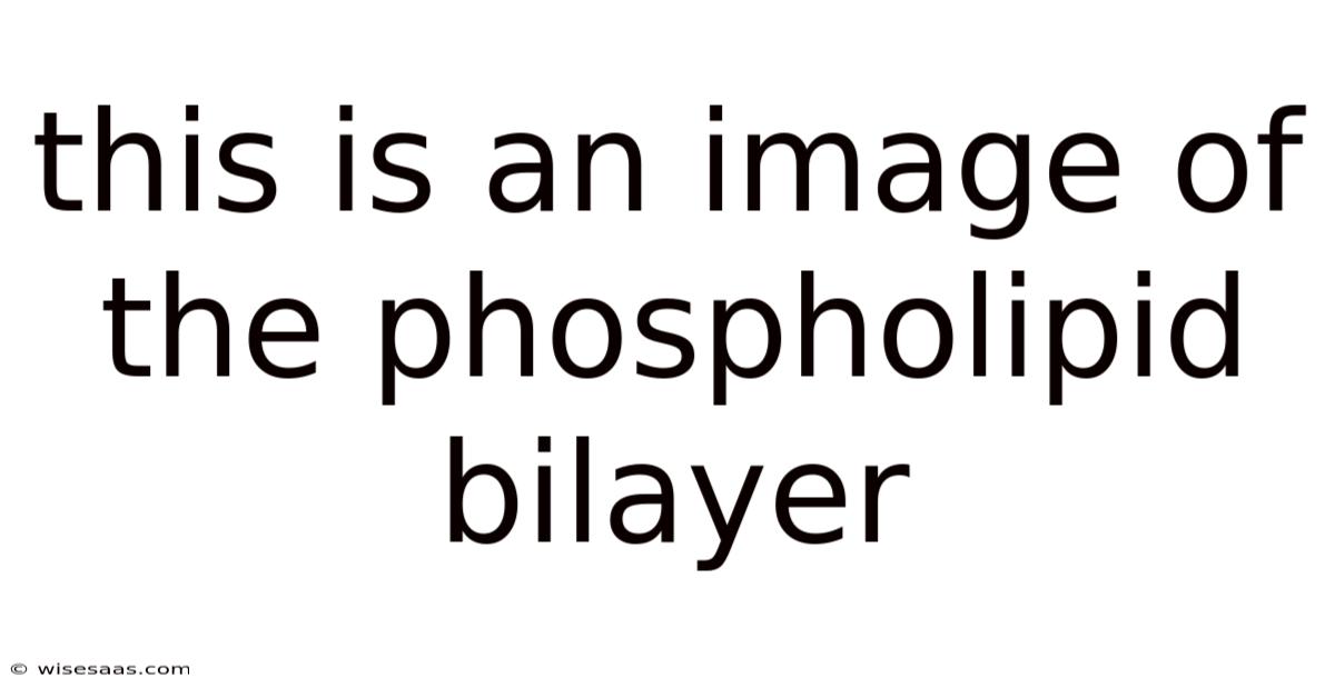This Is An Image Of The Phospholipid Bilayer